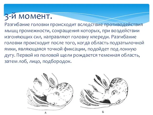 3-й момент. Разгибание головки происходит вследствие противодействия мышц промежности, сокращения которых,