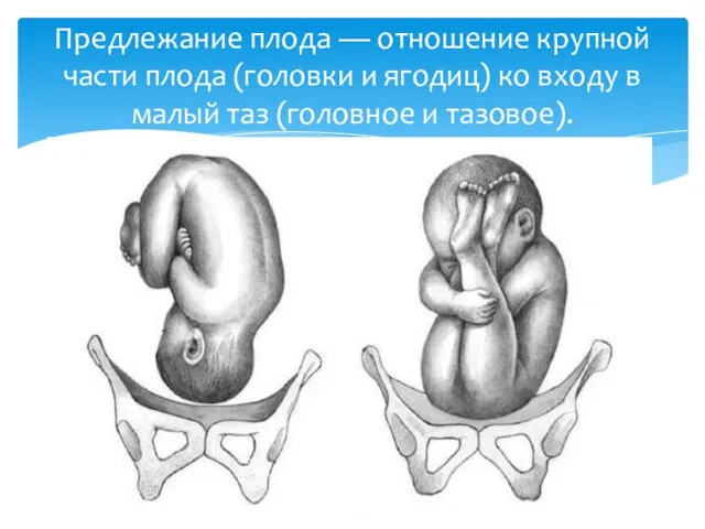 Предлежание плода — отношение крупной части плода (головки и ягодиц) ко