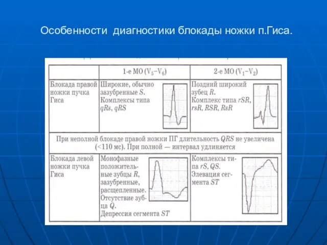 Особенности диагностики блокады ножки п.Гиса.