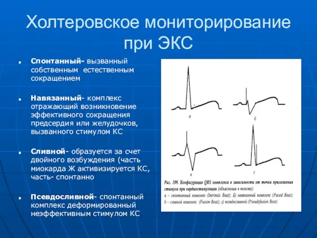 Холтеровское мониторирование при ЭКС Спонтанный- вызванный собственным естественным сокращением Навязанный- комплекс