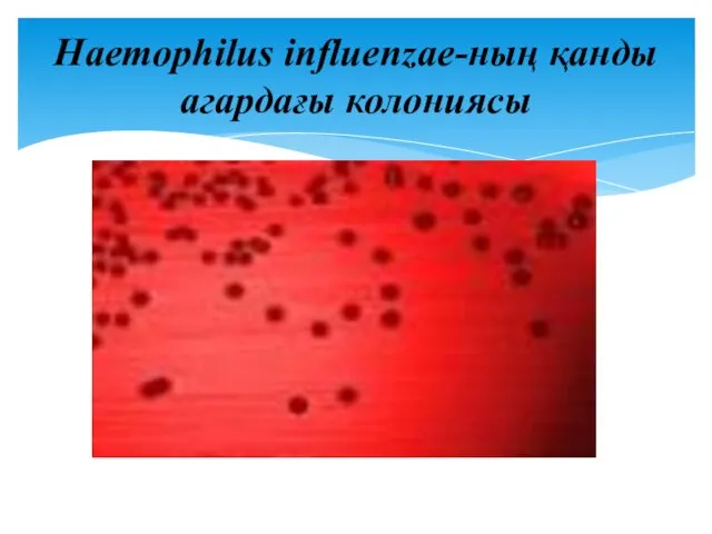 Haemophilus influenzae-ның қанды агардағы колониясы