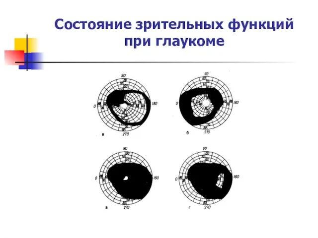 Состояние зрительных функций при глаукоме