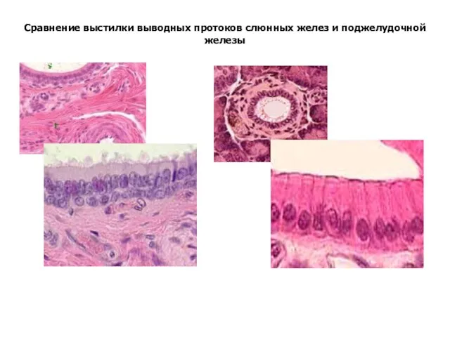 Сравнение выстилки выводных протоков слюнных желез и поджелудочной железы