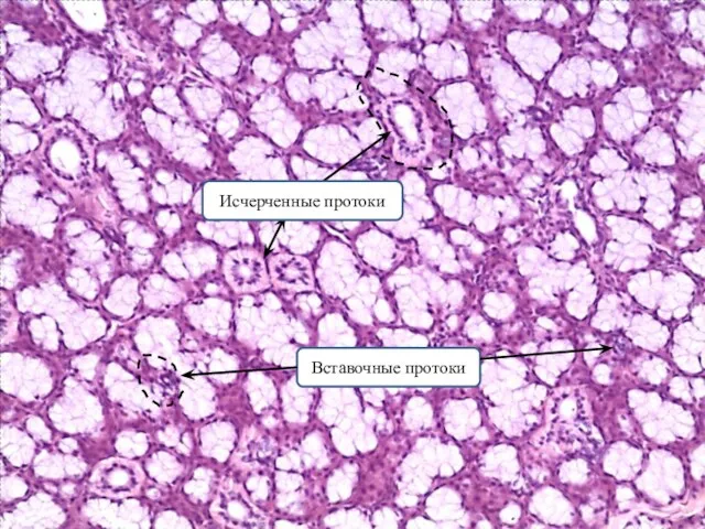 Вставочные протоки Исчерченные протоки