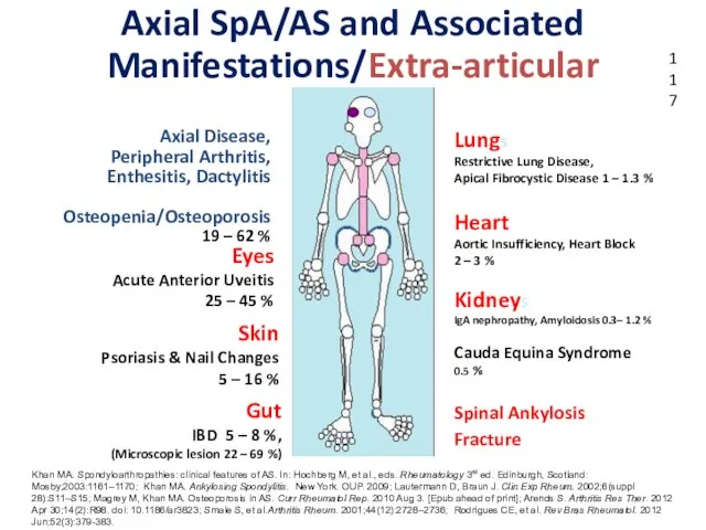 Eyes Acute Anterior Uveitis 25 – 45 % Skin Psoriasis &