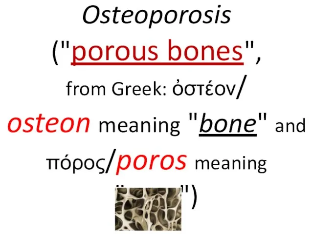 Osteoporosis ("porous bones", from Greek: ὀστέον/ osteon meaning "bone" and πόρος/poros meaning "pore")