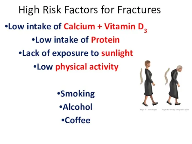 High Risk Factors for Fractures Low intake of Calcium + Vitamin