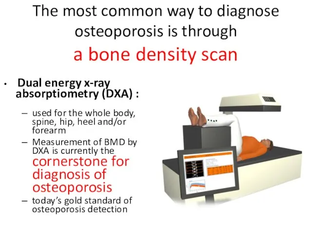 The most common way to diagnose osteoporosis is through a bone