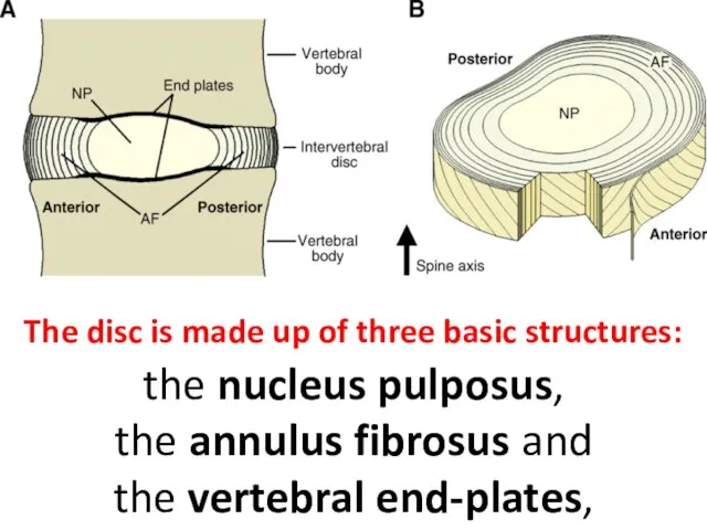 The disc is made up of three basic structures: the nucleus