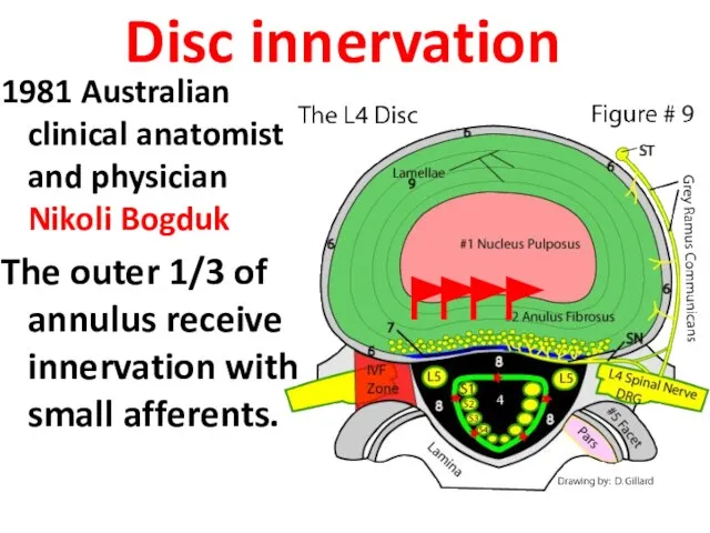 Disc innervation 1981 Australian clinical anatomist and physician Nikoli Bogduk The