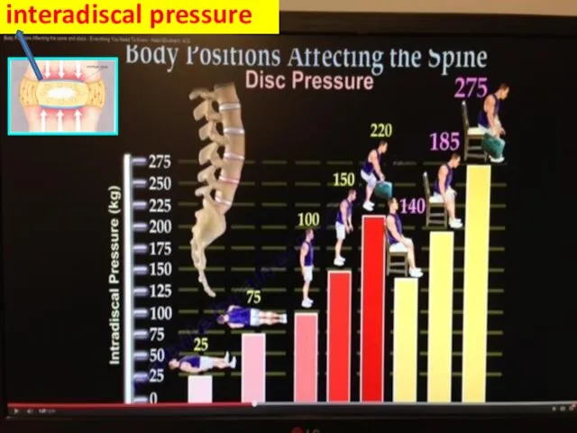 interadiscal pressure