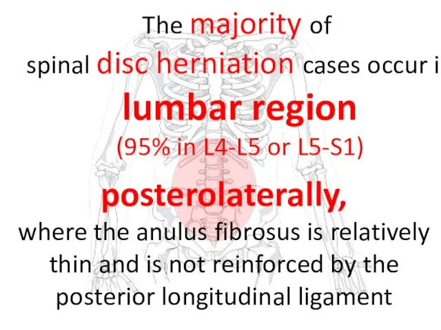 The majority of spinal disc herniation cases occur in lumbar region