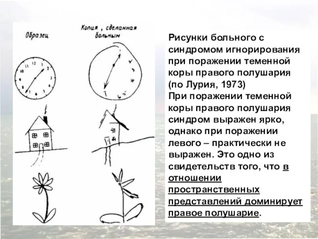 Рисунки больного с синдромом игнорирования при поражении теменной коры правого полушария