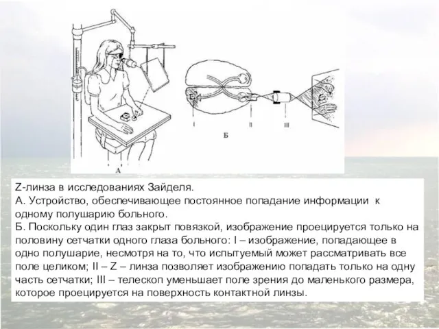 Z-линза в исследованиях Зайделя. А. Устройство, обеспечивающее постоянное попадание информации к