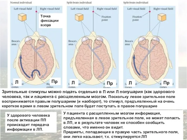 Зрительные стимулы можно подать отдельно в П или Л полушария (как