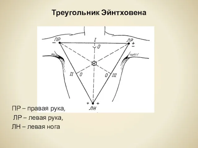 Треугольник Эйнтховена ПР – правая рука, ЛР – левая рука, ЛН – левая нога