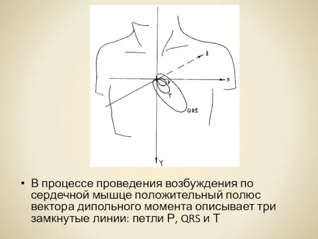 В процессе проведения возбуждения по сердечной мышце положительный полюс вектора дипольного