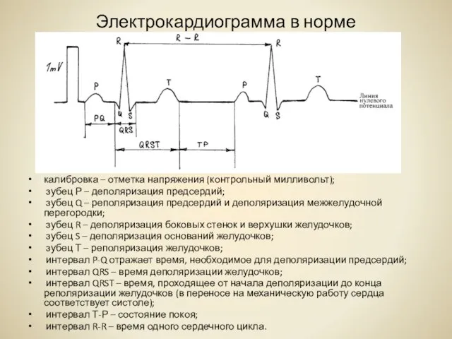 Электрокардиограмма в норме калибровка – отметка напряжения (контрольный милливольт); зубец Р