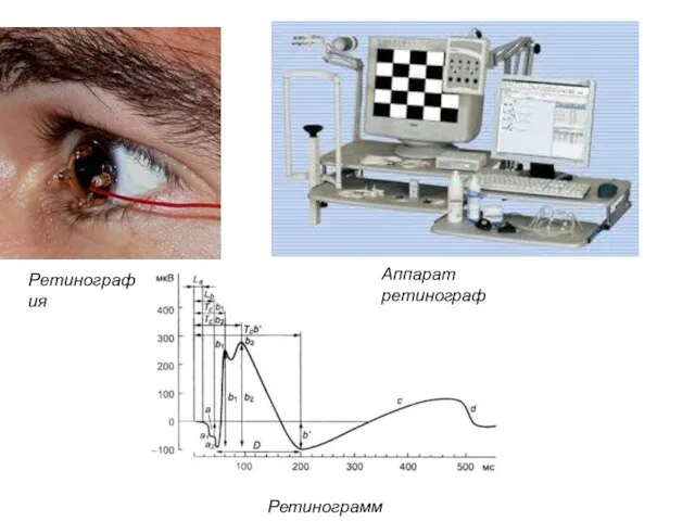 Ретинограмма Ретинография Аппарат ретинограф