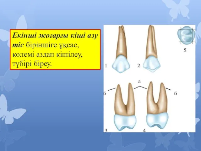 Екінші жоғарғы кіші азу тіс біріншіге ұқсас,көлемі аздап кішілеу,түбірі біреу.