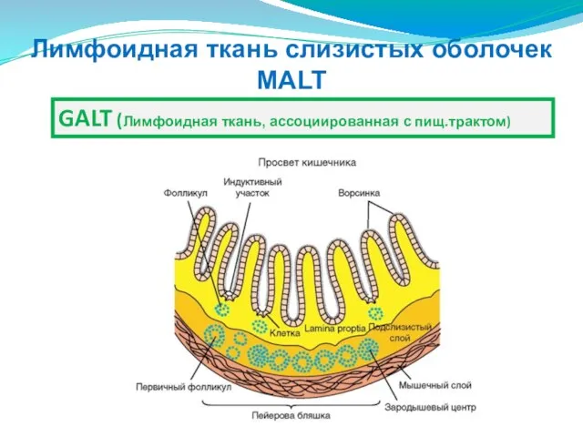 Лимфоидная ткань слизистых оболочек MALT GALT (Лимфоидная ткань, ассоциированная с пищ.трактом)