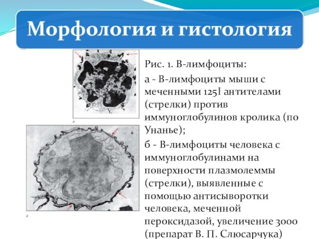 Рис. 1. В-лимфоциты: а - В-лимфоциты мыши с меченными 125I антителами