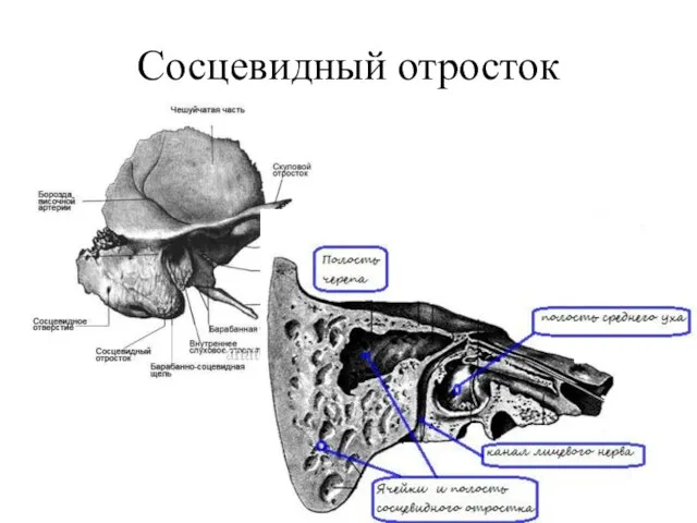 Сосцевидный отросток