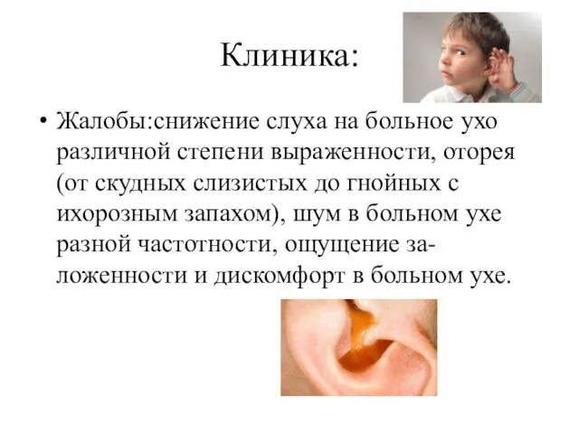 Клиника: Жалобы:снижение слуха на больное ухо различной степени выраженности, оторея(от скудных