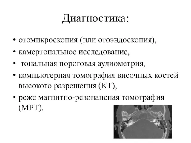 Диагностика: отомикроскопия (или отоэндоскопия), камертональное исследование, тональная пороговая аудиометрия, компьютерная томография