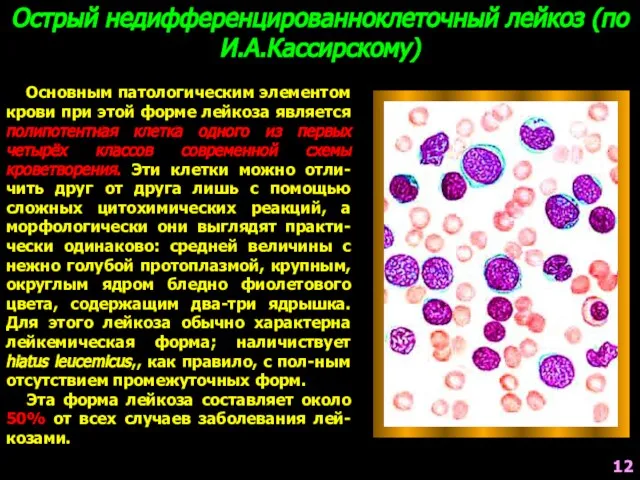 Острый недифференцированноклеточный лейкоз (по И.А.Кассирскому) Основным патологическим элементом крови при этой
