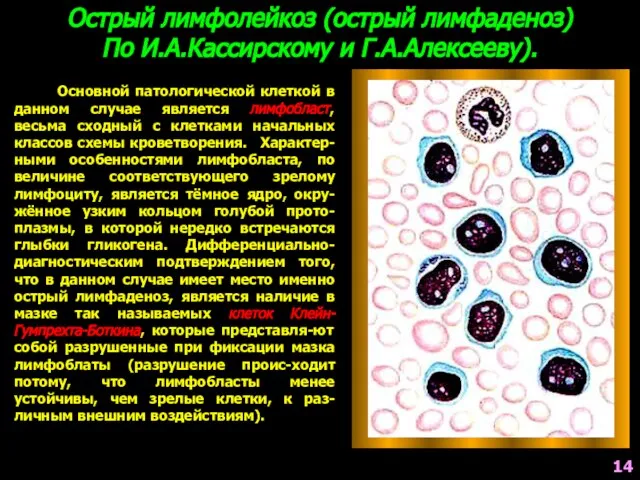 Основной патологической клеткой в данном случае является лимфобласт, весьма сходный с