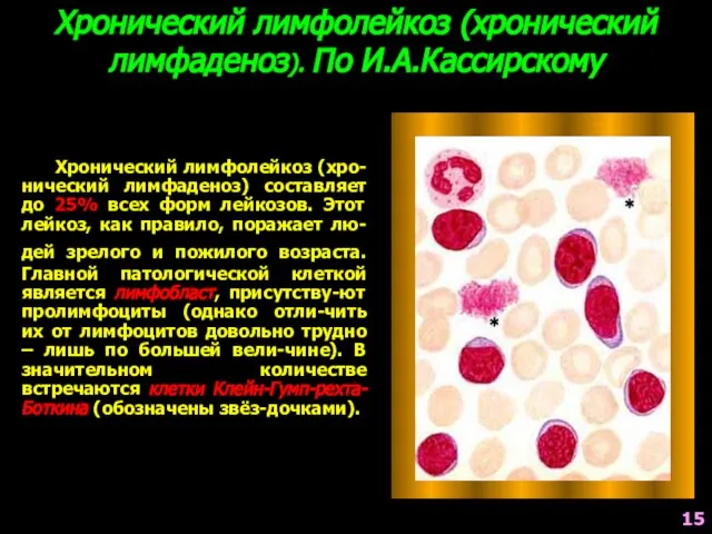 Хронический лимфолейкоз (хро-нический лимфаденоз) составляет до 25% всех форм лейкозов. Этот