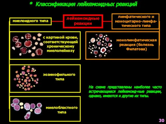 * Классификация лейкемоидных реакций лейкемоидные реакции миелоидного типа лимфатического и моноцитарно-лимфа-