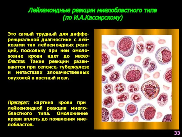 Лейкемоидные реакции миелобластного типа (по И.А.Кассирскому) Это самый трудный для диффе-ренциальной