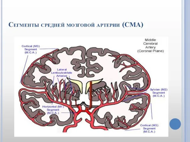 Сегменты средней мозговой артерии (СМА)