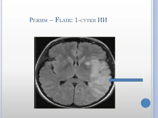 Режим – Flair: 1-сутки ИИ