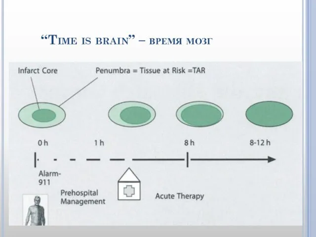 “Time is brain” – время мозг