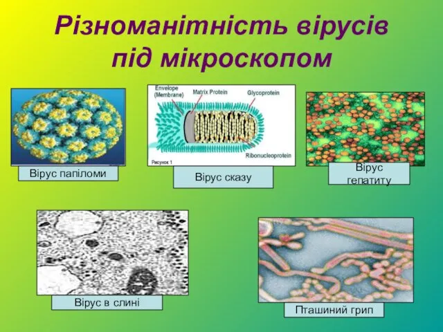 Різноманітність вірусів під мікроскопом Вірус папіломи Вірус сказу Вірус в слині Пташиний грип Вірус гепатиту