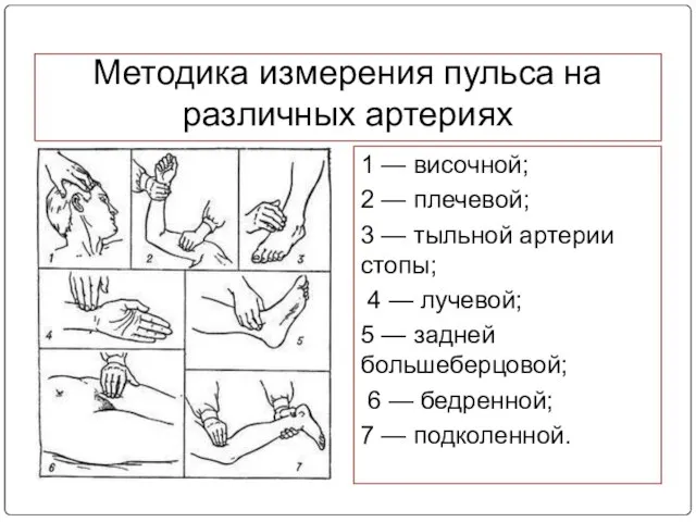 Методика измерения пульса на различных артериях 1 — височной; 2 —