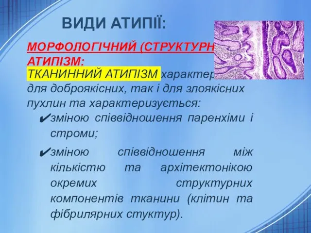 ВИДИ АТИПІЇ: МОРФОЛОГІЧНИЙ (СТРУКТУРНИЙ) АТИПІЗМ: ТКАНИННИЙ АТИПІЗМ характерний як для доброякісних,