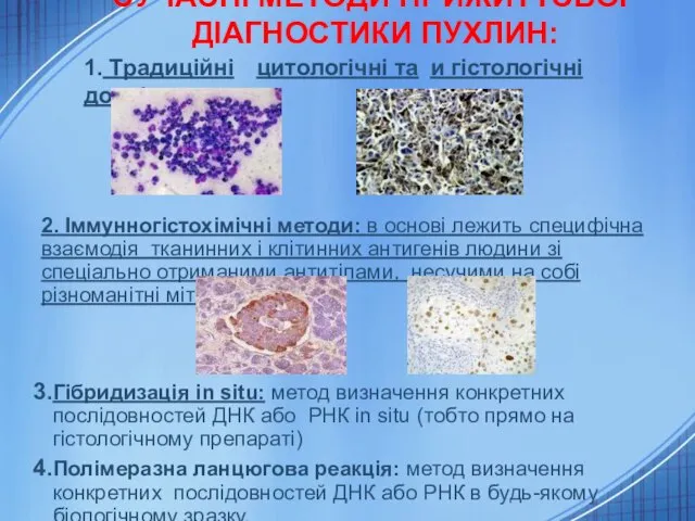 СУЧАСНІ МЕТОДИ ПРИЖИТТЄВОЇ ДІАГНОСТИКИ ПУХЛИН: 2. Іммунногістохімічні методи: в основі лежить