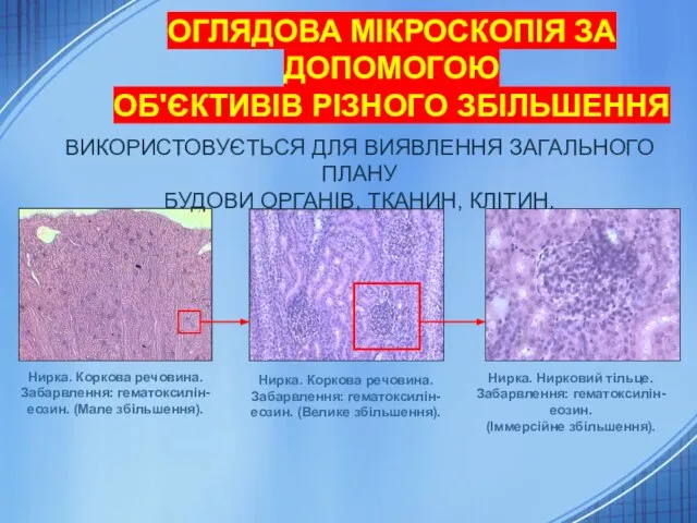 ОГЛЯДОВА МІКРОСКОПІЯ ЗА ДОПОМОГОЮ ОБ'ЄКТИВІВ РІЗНОГО ЗБІЛЬШЕННЯ Нирка. Коркова речовина. Забарвлення: