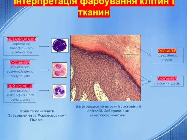 Інтерпретація фарбування клітин і тканин Багатошаровий плоский зроговілий епітелій. Забарвлення: гематоксилін-еозин.