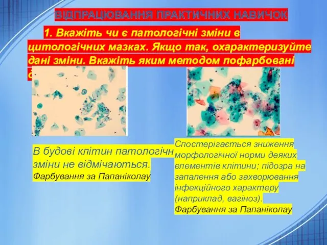 ВІДПРАЦЮВАННЯ ПРАКТИЧНИХ НАВИЧОК 1. Вкажіть чи є патологічні зміни в цитологічних