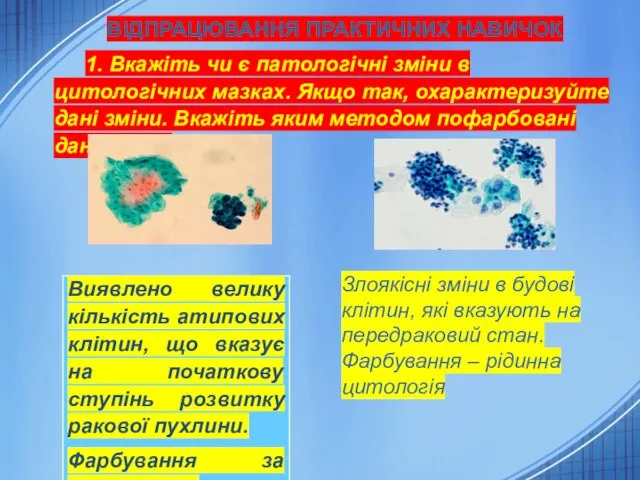 ВІДПРАЦЮВАННЯ ПРАКТИЧНИХ НАВИЧОК 1. Вкажіть чи є патологічні зміни в цитологічних