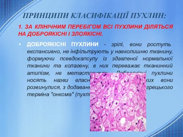 ПРИНЦИПИ КЛАСИФІКАЦІЇ ПУХЛИН: 1. ЗА КЛІНІЧНИМ ПЕРЕБІГОМ ВСІ ПУХЛИНИ ДІЛЯТЬСЯ НА