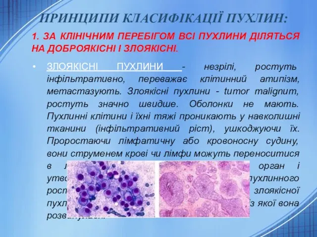 ПРИНЦИПИ КЛАСИФІКАЦІЇ ПУХЛИН: 1. ЗА КЛІНІЧНИМ ПЕРЕБІГОМ ВСІ ПУХЛИНИ ДІЛЯТЬСЯ НА