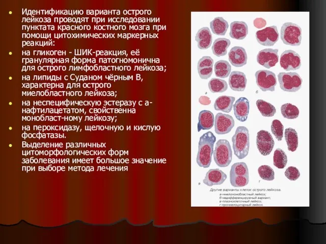 Идентификацию варианта острого лейкоза проводят при исследовании пунктата красного костного мозга