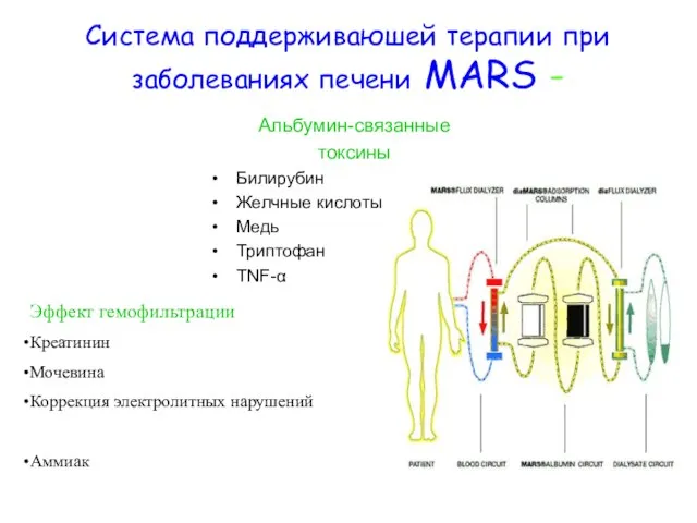 Система поддерживаюшей терапии при заболеваниях печени MARS - Альбумин-связанные токсины Билирубин