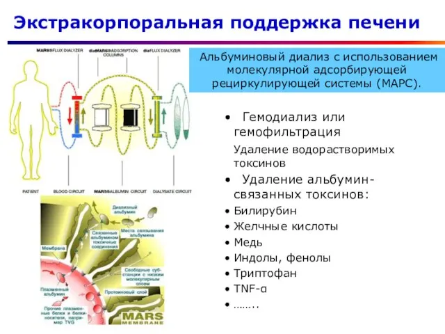 Экстракорпоральная поддержка печени Гемодиализ или гемофильтрация Удаление водорастворимых токсинов Удаление альбумин-связанных